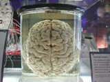 Brains